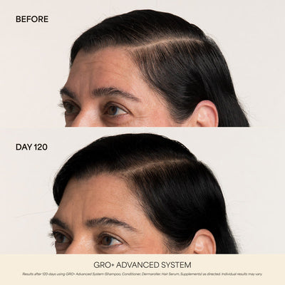 GRO+ Advanced Hair Serum